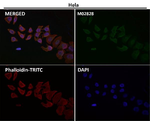 1 - Anti-Cytokeratin 20 KRT20 Rabbit Monoclonal Antibody ABO14180