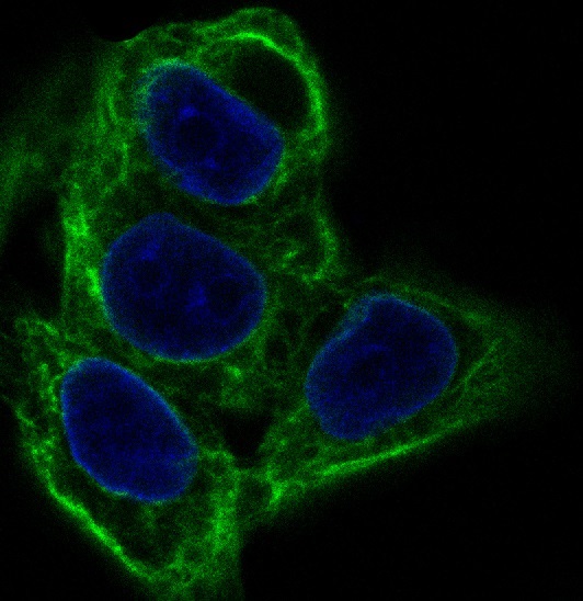 3 - Anti-Cytokeratin 20 KRT20 Rabbit Monoclonal Antibody ABO14180
