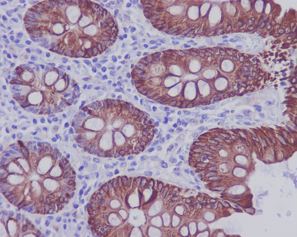 2 - Anti-Cytokeratin 20 KRT20 Rabbit Monoclonal Antibody ABO14180