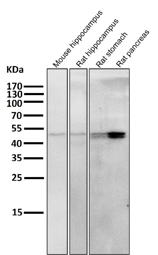1 - Anti-Cytokeratin 20 KRT20 Rabbit Monoclonal Antibody ABO14180