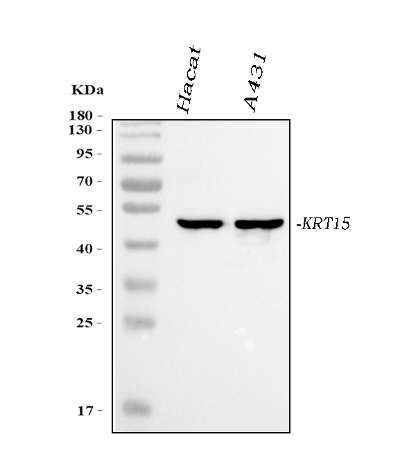 1 - Anti-Cytokeratin 15 Rabbit Monoclonal Antibody ABO14181