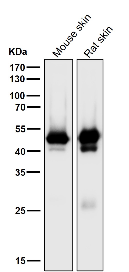 1 - Anti-Cytokeratin 15 Rabbit Monoclonal Antibody ABO14181