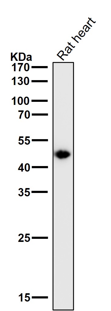 1 - Anti-Cytokeratin 15 Rabbit Monoclonal Antibody ABO14181