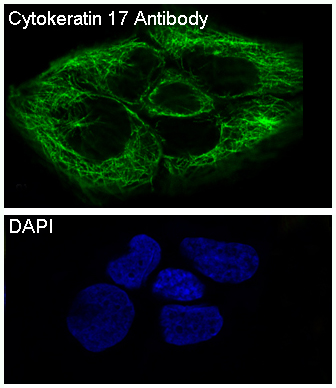 3 - Anti-Cytokeratin 17 Rabbit Monoclonal Antibody ABO14182