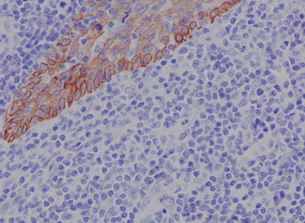 2 - Anti-Cytokeratin 17 Rabbit Monoclonal Antibody ABO14182