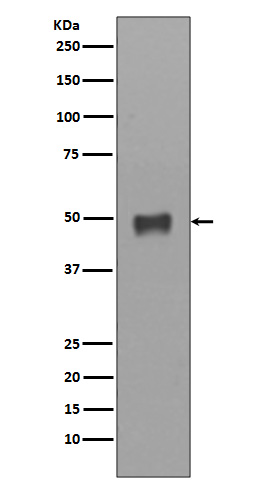 1 - Anti-Cytokeratin 17 Rabbit Monoclonal Antibody ABO14182