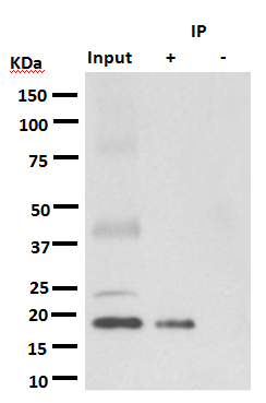 1 - Anti-KRAS+HRAS+NRAS Rabbit Monoclonal Antibody ABO14183