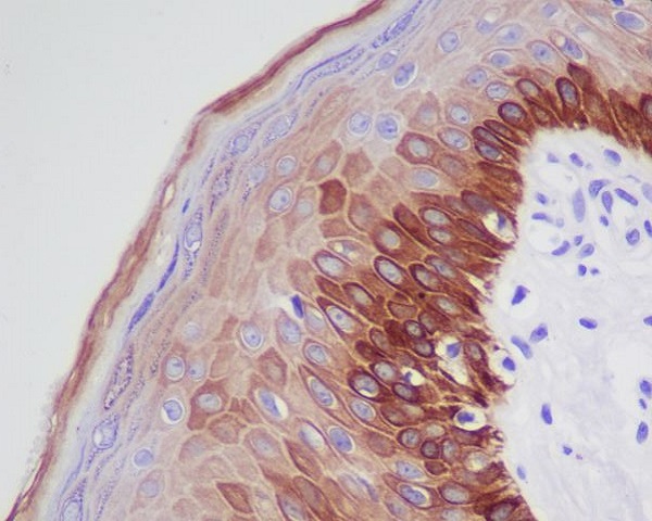 2 - Anti-Cytokeratin 16 KRT16 Rabbit Monoclonal Antibody ABO14184