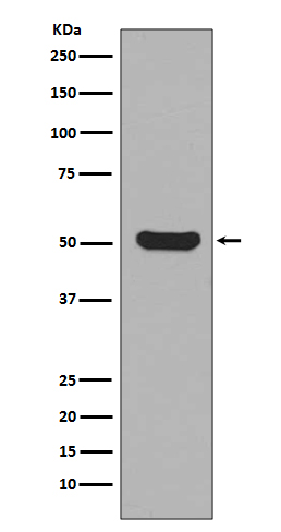 1 - Anti-Cytokeratin 16 KRT16 Rabbit Monoclonal Antibody ABO14184