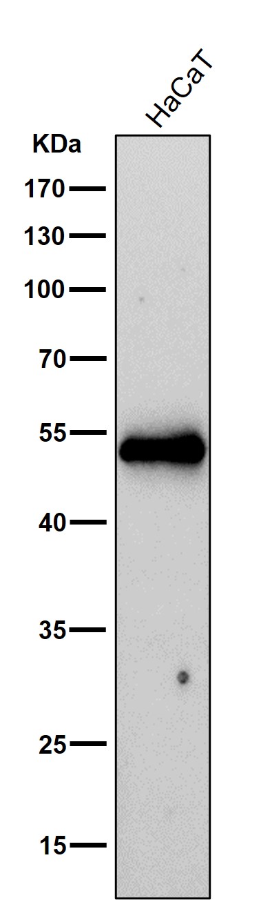 1 - Anti-Cytokeratin 16 KRT16 Rabbit Monoclonal Antibody ABO14184