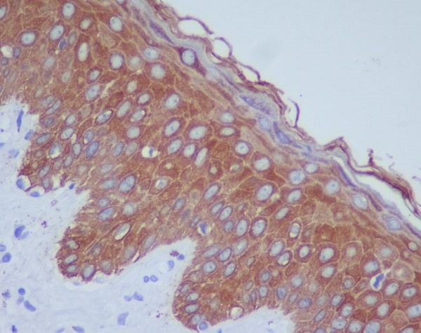 2 - Anti-Cytokeratin 14 KRT14 Rabbit Monoclonal Antibody ABO14185