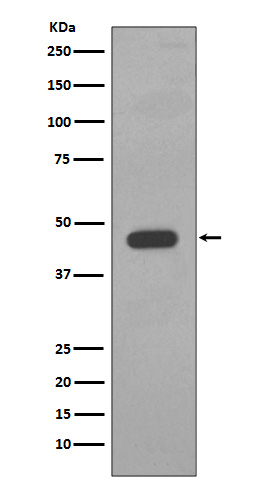 1 - Anti-Cytokeratin 14 KRT14 Rabbit Monoclonal Antibody ABO14185