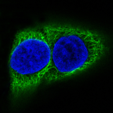 3 - Anti-Cytokeratin 10 KRT10 Rabbit Monoclonal Antibody ABO14186
