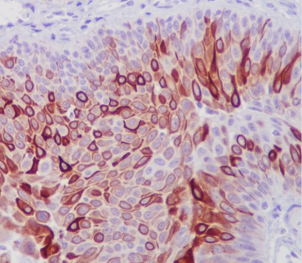 2 - Anti-Cytokeratin 10 KRT10 Rabbit Monoclonal Antibody ABO14186