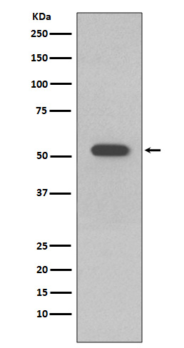 1 - Anti-Cytokeratin 10 KRT10 Rabbit Monoclonal Antibody ABO14186