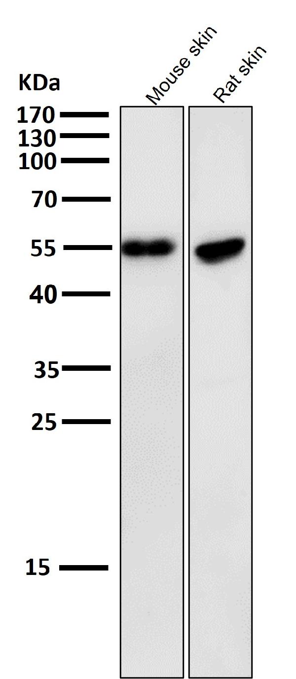 1 - Anti-Cytokeratin 10 KRT10 Rabbit Monoclonal Antibody ABO14186