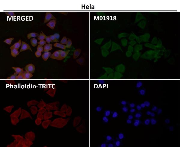 1 - Anti-IKK alpha+beta CHUK Rabbit Monoclonal Antibody ABO14187