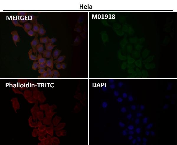 1 - Anti-IKK alpha+beta CHUK Rabbit Monoclonal Antibody ABO14187