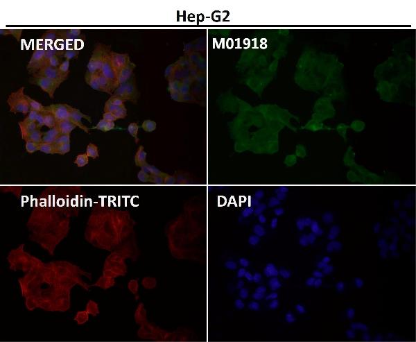 1 - Anti-IKK alpha+beta CHUK Rabbit Monoclonal Antibody ABO14187