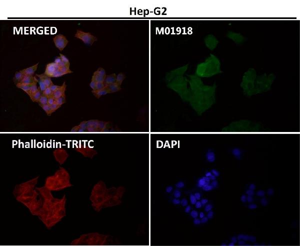 1 - Anti-IKK alpha+beta CHUK Rabbit Monoclonal Antibody ABO14187