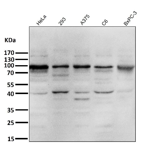 1 - Anti-IKK alpha+beta CHUK Rabbit Monoclonal Antibody ABO14187