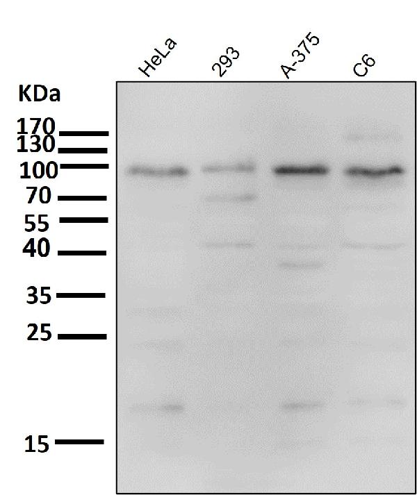 1 - Anti-IKK alpha+beta CHUK Rabbit Monoclonal Antibody ABO14187