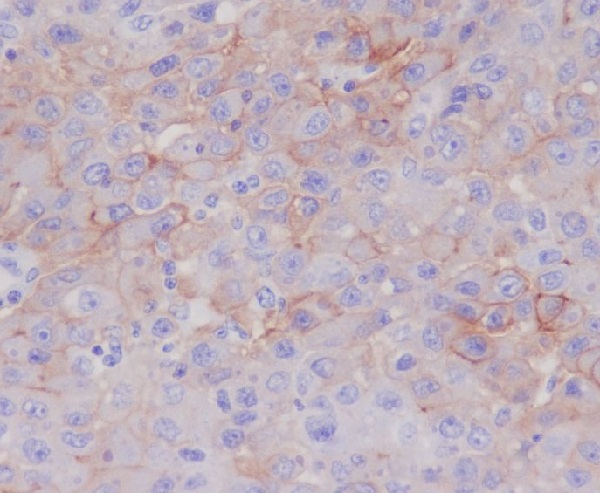 2 - Anti-P Glycoprotein ABCB1 Rabbit Monoclonal Antibody ABO14188