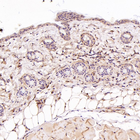 2 - Anti-P Glycoprotein ABCB1 Rabbit Monoclonal Antibody ABO14188