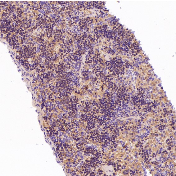 2 - Anti-P Glycoprotein ABCB1 Rabbit Monoclonal Antibody ABO14188