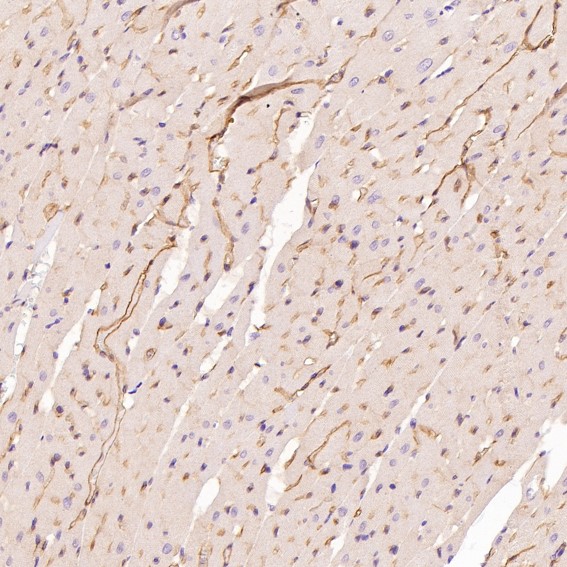 2 - Anti-P Glycoprotein ABCB1 Rabbit Monoclonal Antibody ABO14188
