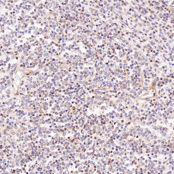 2 - Anti-P Glycoprotein ABCB1 Rabbit Monoclonal Antibody ABO14188