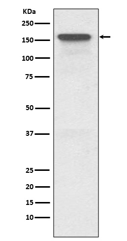 1 - Anti-P Glycoprotein ABCB1 Rabbit Monoclonal Antibody ABO14188