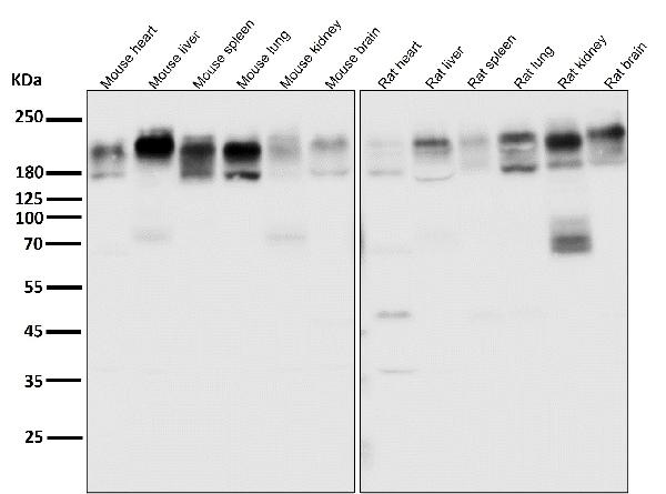 1 - Anti-P Glycoprotein ABCB1 Rabbit Monoclonal Antibody ABO14188