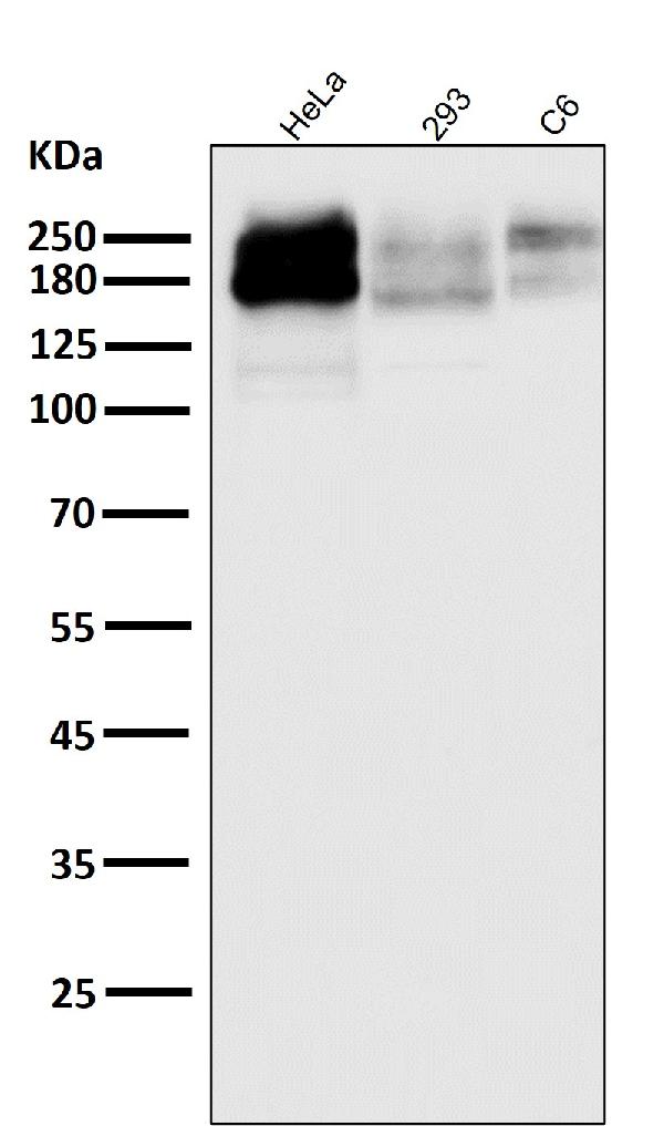 1 - Anti-P Glycoprotein ABCB1 Rabbit Monoclonal Antibody ABO14188
