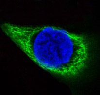 3 - Anti-Cytokeratin 14 KRT14 Rabbit Monoclonal Antibody ABO14189