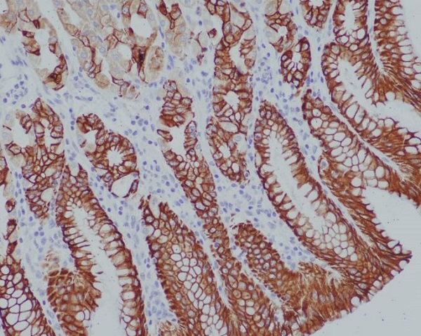 2 - Anti-Cytokeratin 14 KRT14 Rabbit Monoclonal Antibody ABO14189