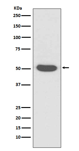1 - Anti-Cytokeratin 14 KRT14 Rabbit Monoclonal Antibody ABO14189