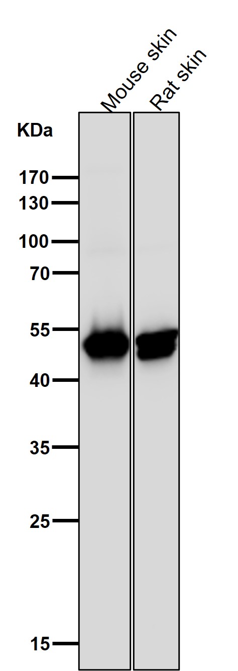 1 - Anti-Cytokeratin 14 KRT14 Rabbit Monoclonal Antibody ABO14189