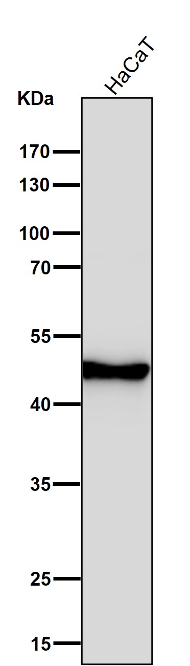 1 - Anti-Cytokeratin 14 KRT14 Rabbit Monoclonal Antibody ABO14189