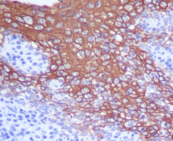 2 - Anti-Cytokeratin 13 Rabbit Monoclonal Antibody ABO14191