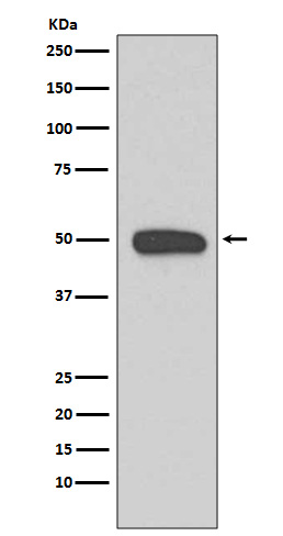 1 - Anti-Cytokeratin 13 Rabbit Monoclonal Antibody ABO14191