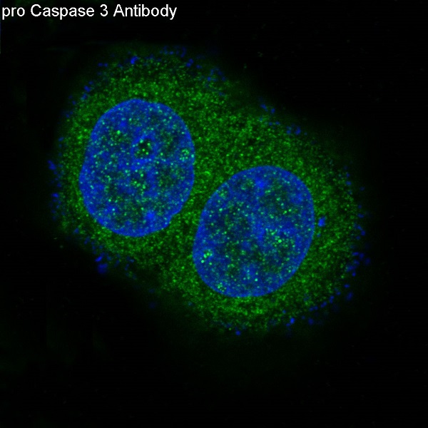 3 - Anti-pro Caspase 10 Rabbit Monoclonal Antibody ABO14192
