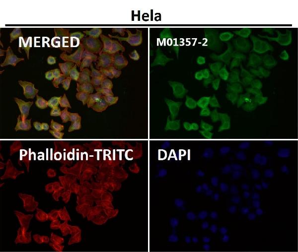 1 - Anti-Cytokeratin 18 Krt18 Rabbit Monoclonal Antibody ABO14193