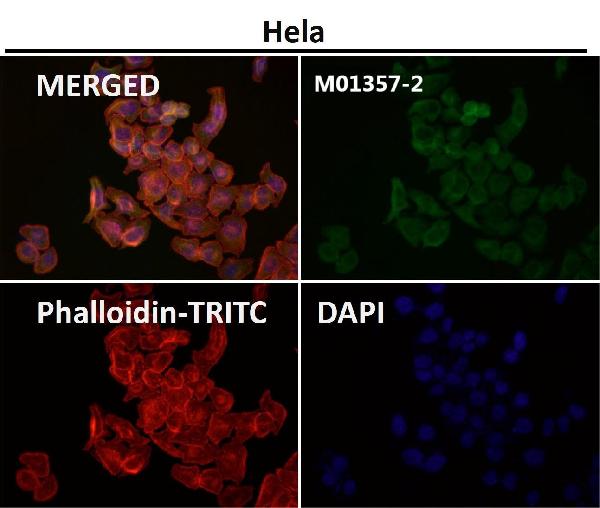 1 - Anti-Cytokeratin 18 Krt18 Rabbit Monoclonal Antibody ABO14193