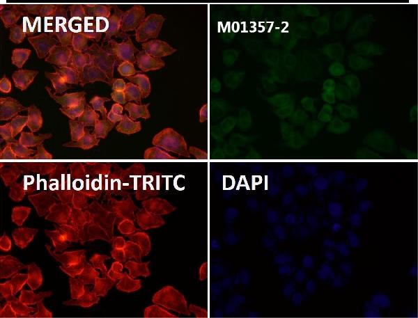 1 - Anti-Cytokeratin 18 Krt18 Rabbit Monoclonal Antibody ABO14193