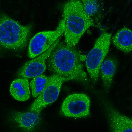 3 - Anti-Cytokeratin 18 Krt18 Rabbit Monoclonal Antibody ABO14193