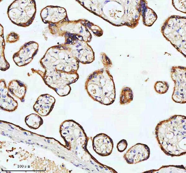 2 - Anti-Cytokeratin 18 Krt18 Rabbit Monoclonal Antibody ABO14193