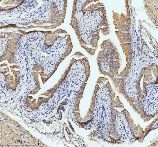 2 - Anti-Cytokeratin 18 Krt18 Rabbit Monoclonal Antibody ABO14193