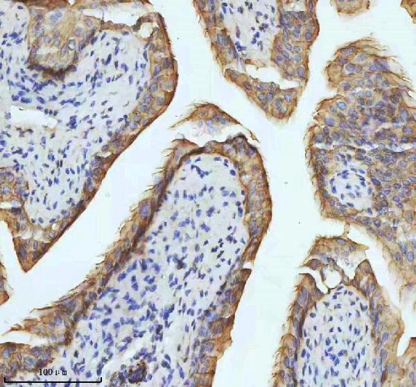 2 - Anti-Cytokeratin 18 Krt18 Rabbit Monoclonal Antibody ABO14193