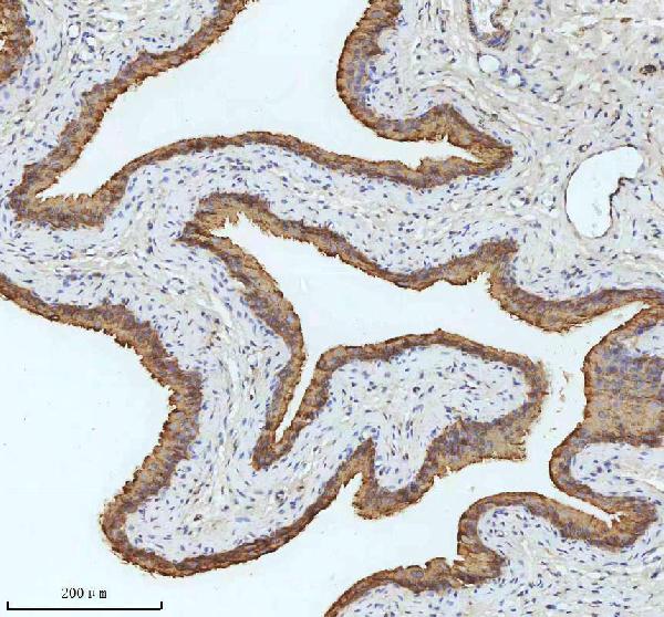 2 - Anti-Cytokeratin 18 Krt18 Rabbit Monoclonal Antibody ABO14193